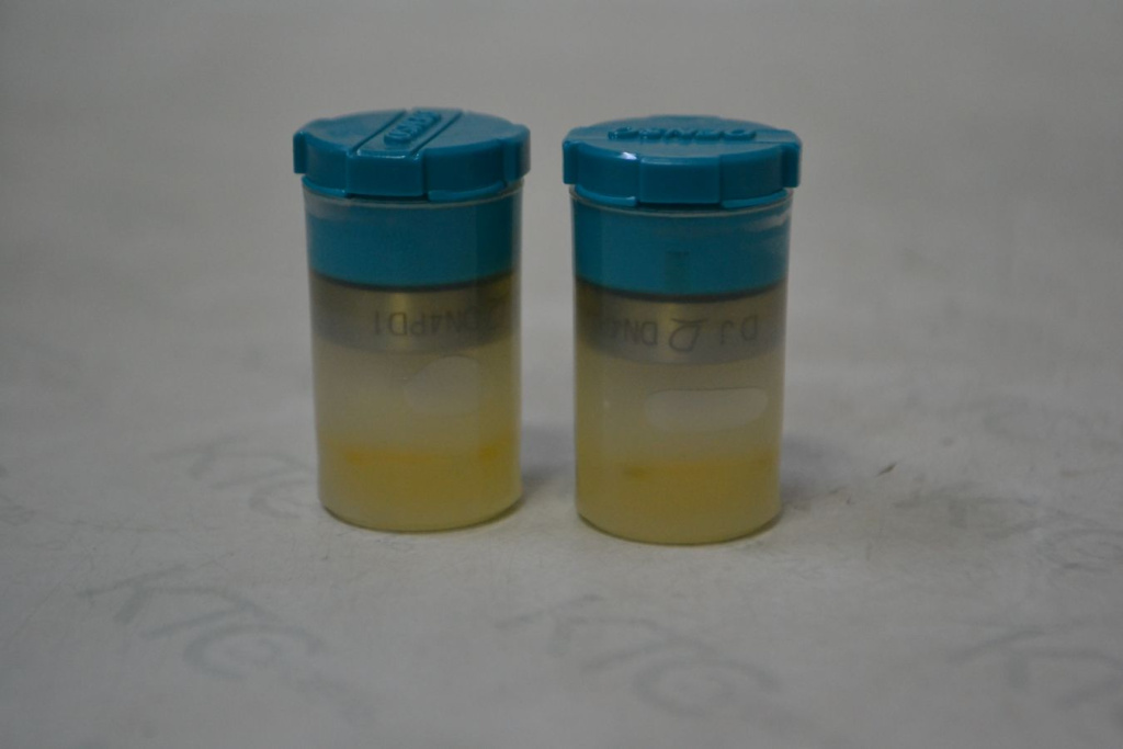 Картинка 093400-5010 распылитель с доставкой по всей россии. ктс-дизель