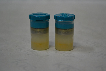 Распылитель dn0pd21 kubota tractor v1405